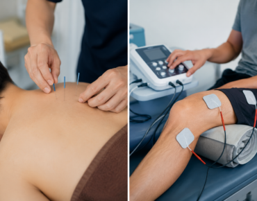 Dry Needling vs Electrotherapy: Which Physiotherapy Technique Works Better for Chronic Pain?