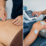 Dry Needling vs Electrotherapy: Which Physiotherapy Technique Works Better for Chronic Pain?