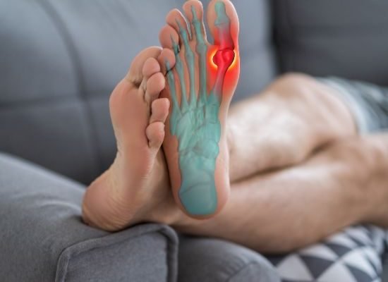 Plantar Fasciitis Physiotherapy
