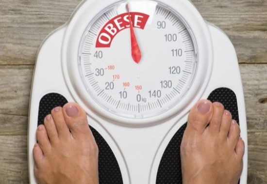 obesity physiotherapy